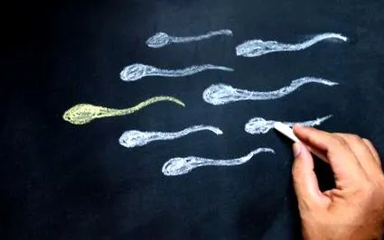 spermiogram