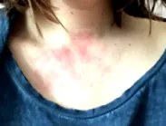 hogyan mark