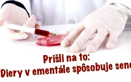 brânză care