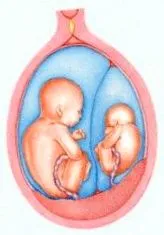 multipli