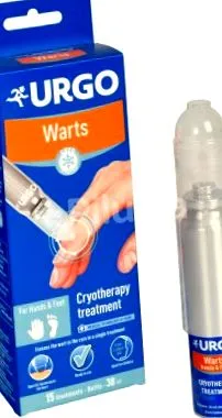 congelarea