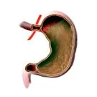 portal mucoasei gastrice