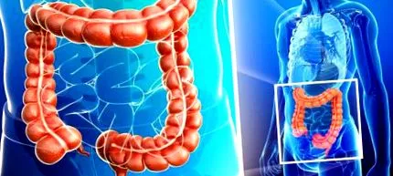 medicamente intestinului