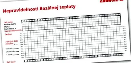 bazală