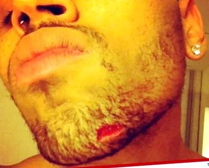 Chris Brown
