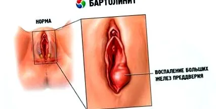 причини