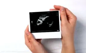 inseminării