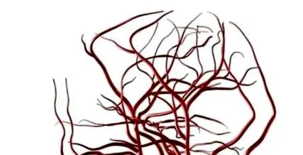 necesită vascular