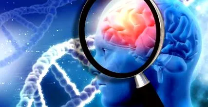 alzheimer alzheimer