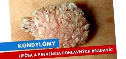 mici