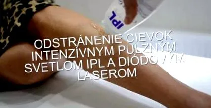 telurilor