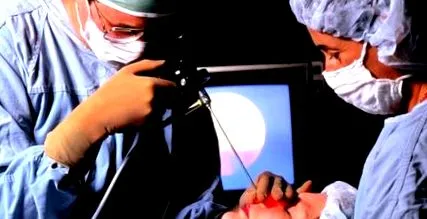 tratamentul bacterioterapia