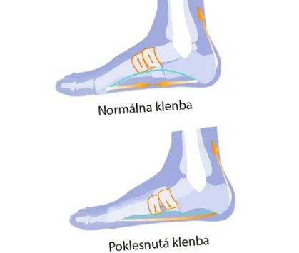 curburii longitudinale