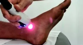 rehabilica eszközterápia