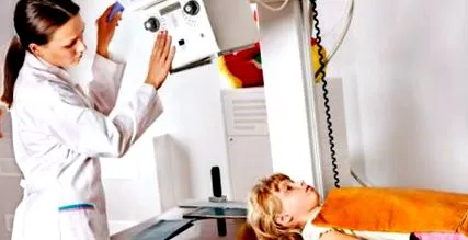 copiii radiografiați