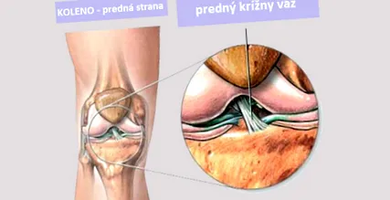 încrucișat ligament
