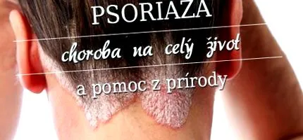 psoriazisul vieții