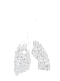 sinusurilor