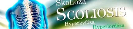 hipericifoză scolioză-cum