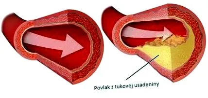 curăță substanță