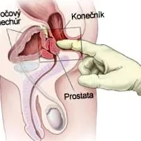 prostată prin prostată prin