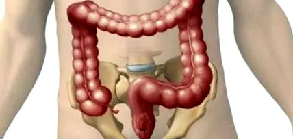 avea kilograme