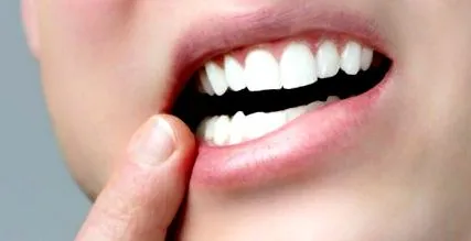 dentară sănătoasă