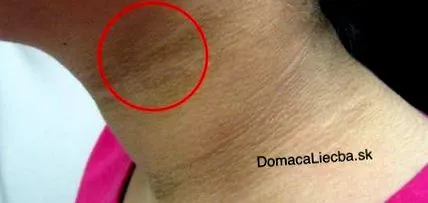 simptome diabetului