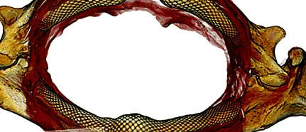 pană