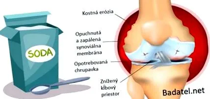 pentru