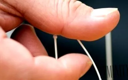 acupunctura este