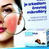 eczemei ​​atopice