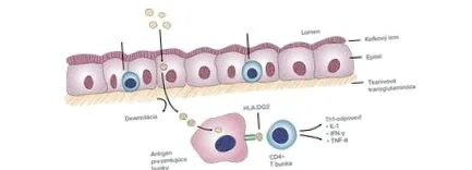 celiaca