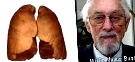 cronice cronice