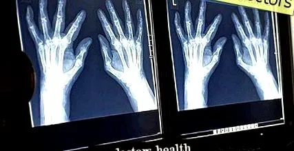 diagnosticul