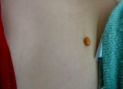 infanrix