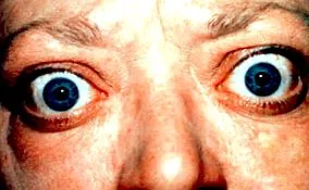 graves-kór