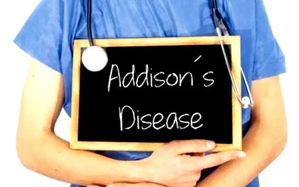 addison-kór