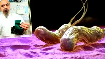 helicobacter