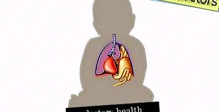 hernia