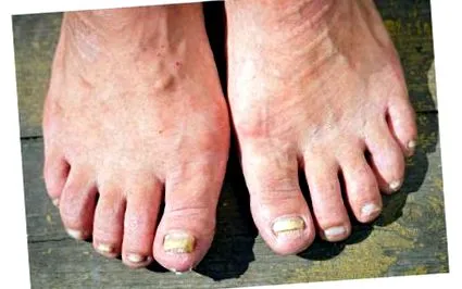 mucegaiul care