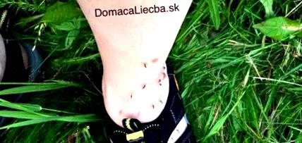 mușcă persoană