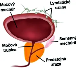 depunerea prostata