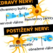 altă parte