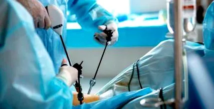 laparoscopia