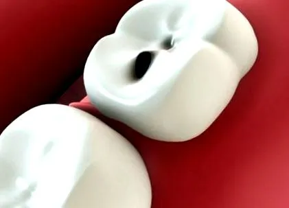 зъбите