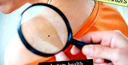 melanomul