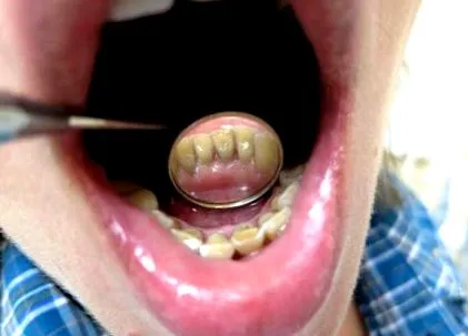 dentară