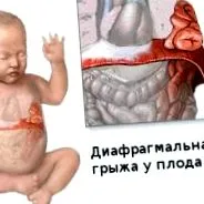 новородени