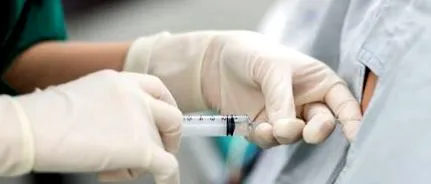 epidurală analgezie